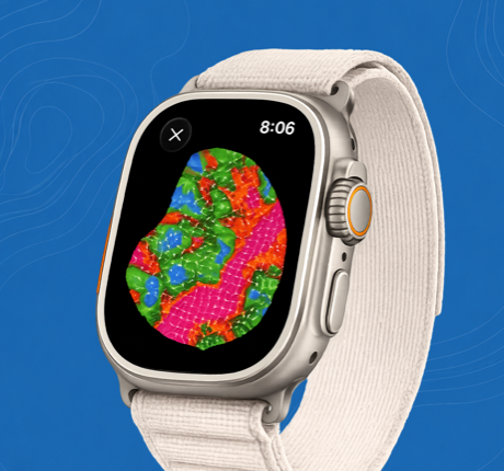 ForeFun Golf GPS Apple Watch screens for green maps, scoring, and Play Like yardage